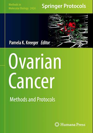 Ovarian Cancer