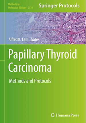 Papillary Thyroid Carcinoma