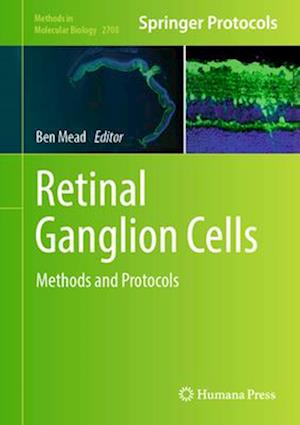 Retinal Ganglion Cells