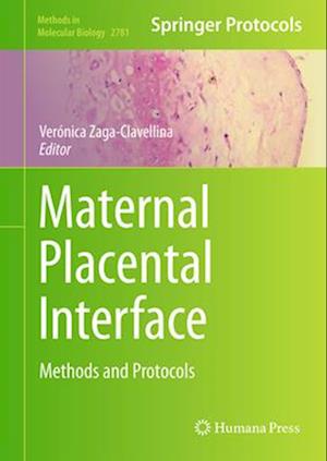 Maternal Placental Interface