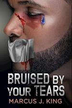 Bruised by your Tears 