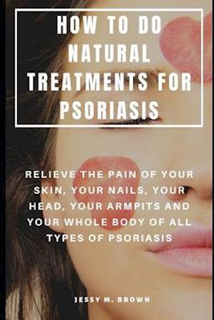 How to Do Natural Treatments for Psoriasis