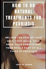 How to Do Natural Treatments for Psoriasis