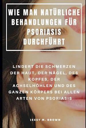 Wie Man Natürliche Behandlungen Für Psoriasis Durchführt