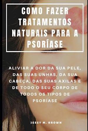 Como Fazer Tratamentos Naturais Para a Psoríase