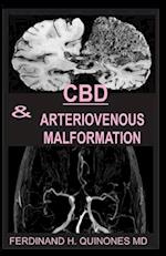 CBD & Arteriovenous Malformation