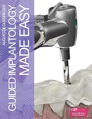 Guided Implantology Made Easy