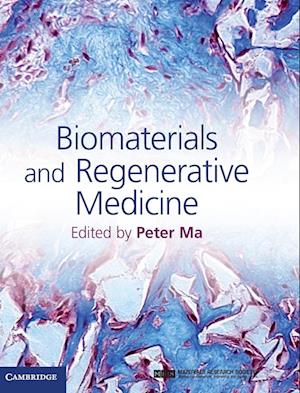 Biomaterials and Regenerative Medicine