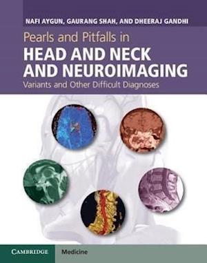 Pearls and Pitfalls in Head and Neck and Neuroimaging