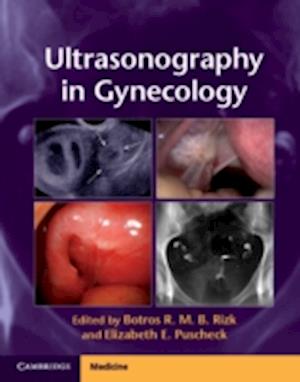 Ultrasonography in Gynecology