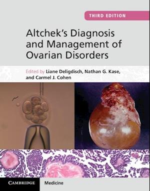 Altchek's Diagnosis and Management of Ovarian Disorders