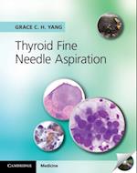 Thyroid Fine Needle Aspiration