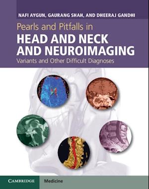 Pearls and Pitfalls in Head and Neck and Neuroimaging