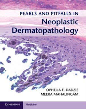Pearls and Pitfalls in Neoplastic Dermatopathology with Online Access
