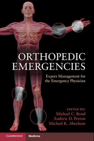 Orthopedic Emergencies