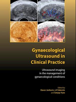 Gynaecological Ultrasound in Clinical Practice