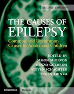 The Causes of Epilepsy