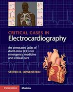 Critical Cases in Electrocardiography