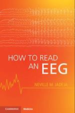 How to Read an EEG