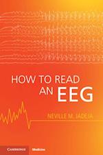 How to Read an EEG