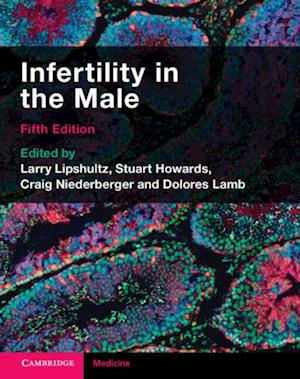 Infertility in the Male