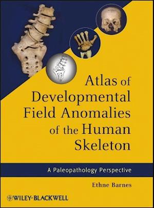 Atlas of Developmental Field Anomalies of the Human Skeleton – A Paleopathology Perspective