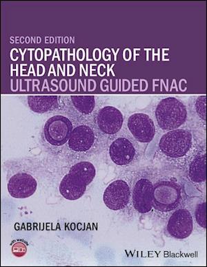 Cytopathology of the Head and Neck – Ultrasound Guided FNAC 2e