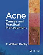 Acne – Causes and Practical Management