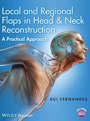 Local and Regional Flaps in Head and Neck Reconstruction