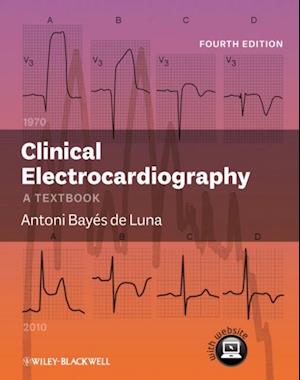 Clinical Electrocardiography