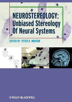 Neurostereology – Unbiased Stereology of Neural Systems