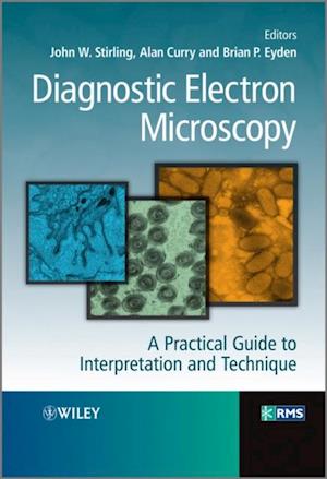 Diagnostic Electron Microscopy