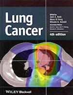 Lung Cancer 4e
