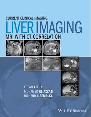 Liver Imaging