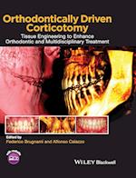 Orthodontically Driven Corticotomy – Tissue Engineering to Enhance Orthodontic and Multidisciplinary Treatment