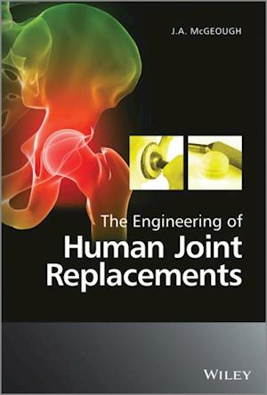 Engineering of Human Joint Replacements