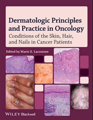 Dermatologic Principles and Practice in Oncology