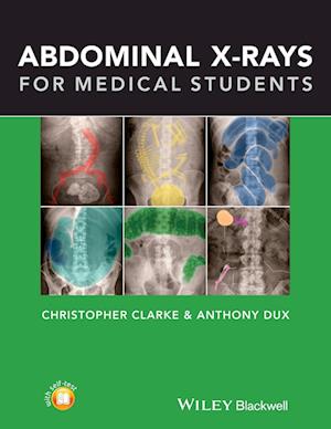 Abdominal X–rays for Medical Students