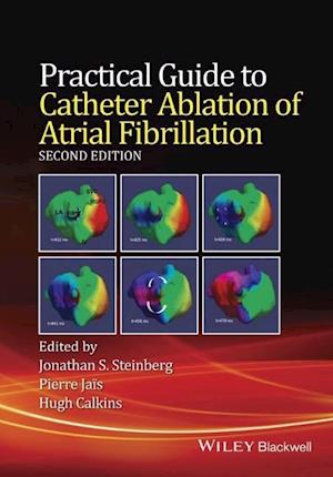 Practical Guide to Catheter Ablation of Atrial Fibrillation