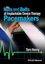 The Nuts and Bolts of Implantable Device Therapy – Pacemakers