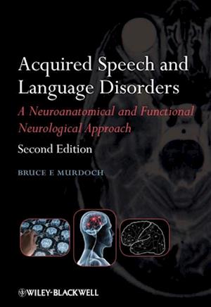 Acquired Speech and Language Disorders