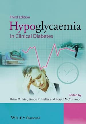 Hypoglycaemia in Clinical Diabetes