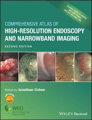 Comprehensive Atlas of High Resolution Endoscopy and Narrowband Imaging, 2nd Edition