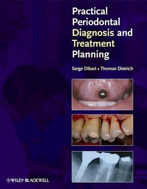 Practical Periodontal Diagnosis and Treatment Planning