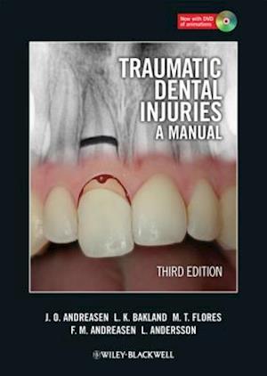 Traumatic Dental Injuries