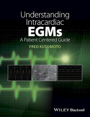 Understanding Intracardiac EGMs