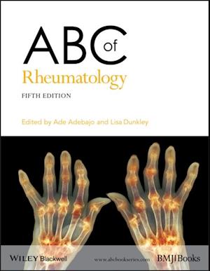 ABC of Rheumatology