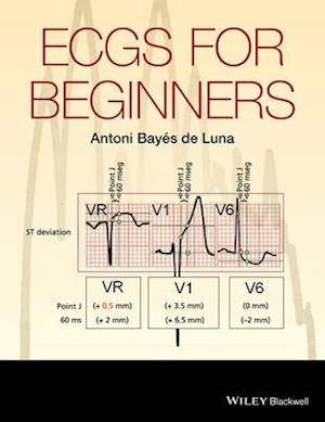 ECGs for Beginners