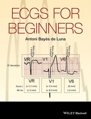 ECGs for Beginners