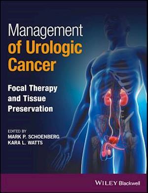 Management of Urologic Cancer